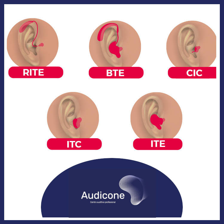 Clasificación de Audífonos